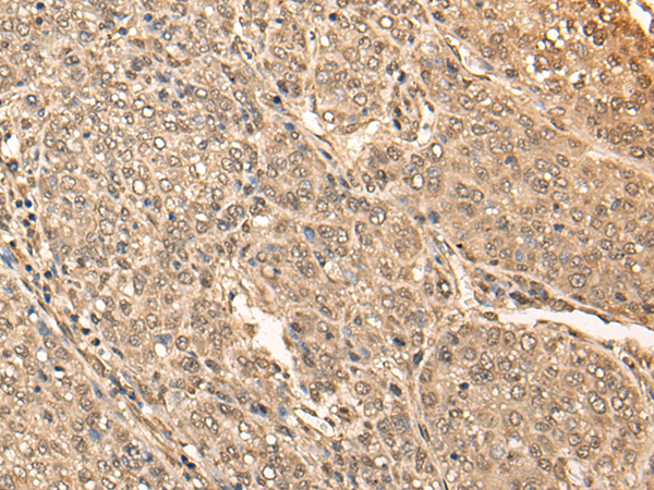 Rabbit Polyclonal Antibody to BRF2