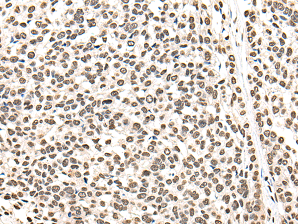Rabbit Polyclonal Antibody to BRF1