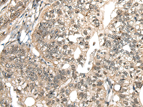 Rabbit Polyclonal Antibody to MCPH1