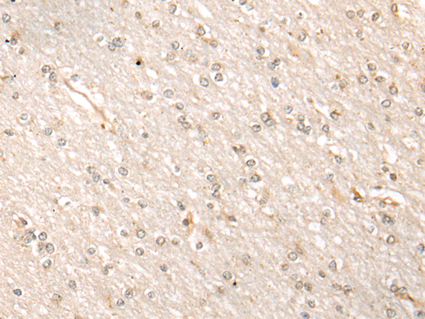 Rabbit Polyclonal Antibody to BRPF3