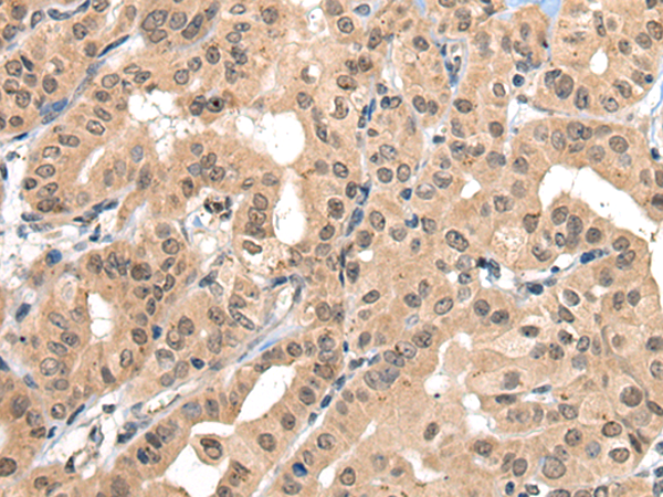 Rabbit Polyclonal Antibody to ZBTB44