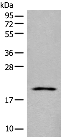 Rabbit Polyclonal Antibody to BTF3L4