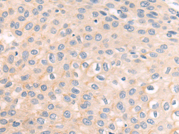 Rabbit Polyclonal Antibody to BTK