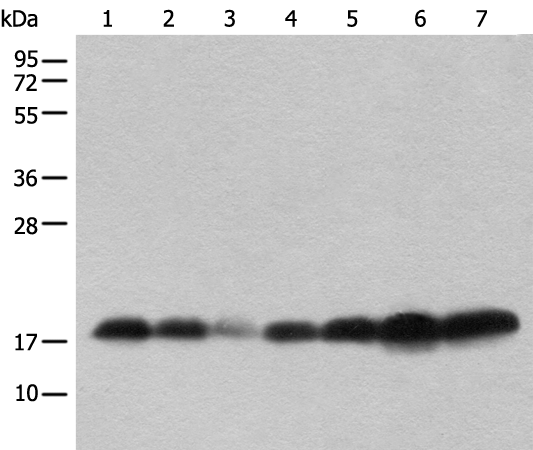 Rabbit Polyclonal Antibody to BUD31