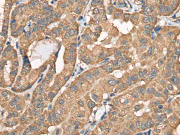 Rabbit Polyclonal Antibody to BCHE