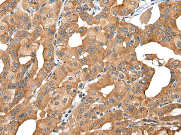 Rabbit Polyclonal Antibody to INF2