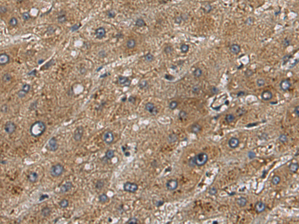 Rabbit Polyclonal Antibody to BBOF1