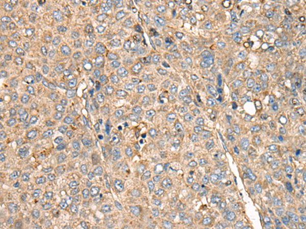 Rabbit Polyclonal Antibody to MEIOB