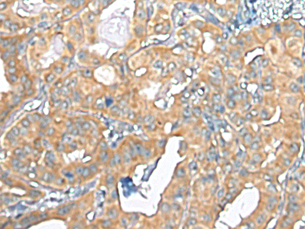 Rabbit Polyclonal Antibody to TMEM256