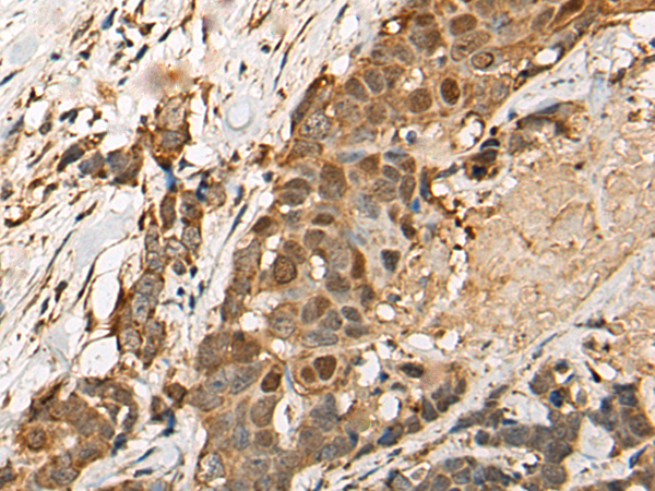 Rabbit Polyclonal Antibody to HEATR9