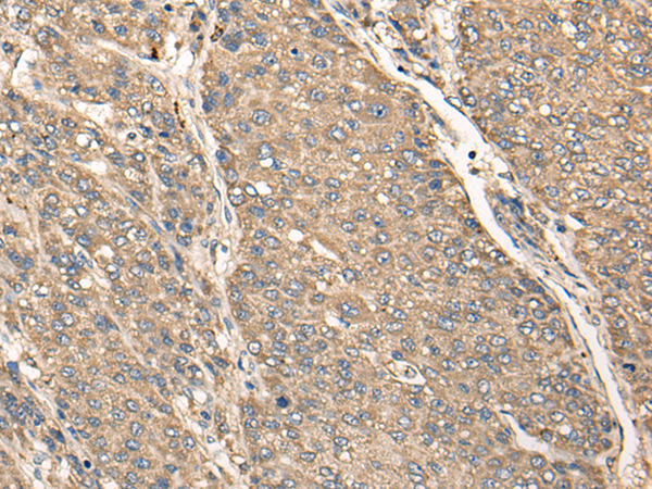 Rabbit Polyclonal Antibody to C17orf67