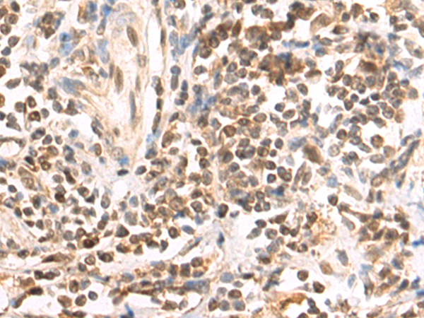 Rabbit Polyclonal Antibody to LDLRAD4