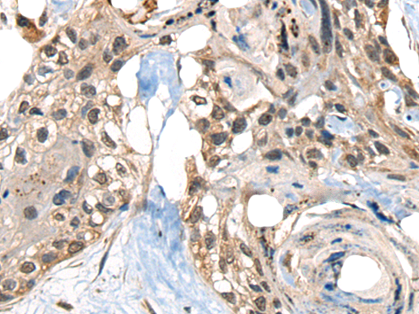Rabbit Polyclonal Antibody to TIMM21
