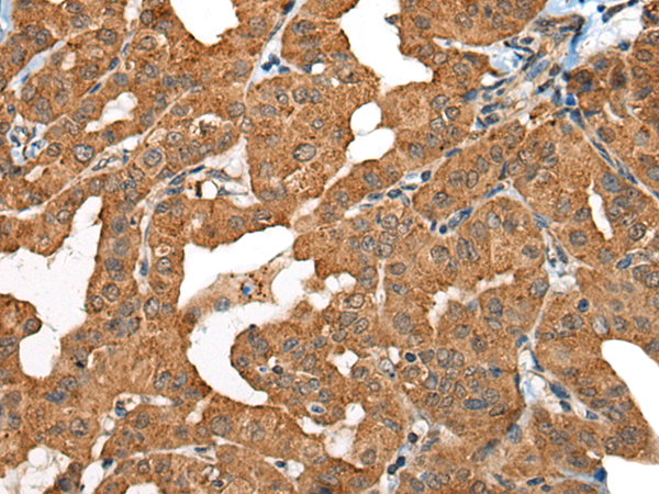 Rabbit Polyclonal Antibody to RMC1