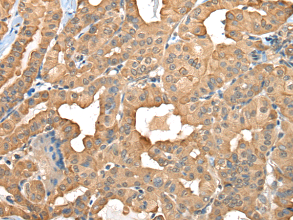 Rabbit Polyclonal Antibody to C1GALT1C1