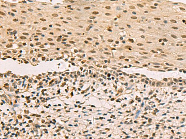 Rabbit Polyclonal Antibody to LRIF1