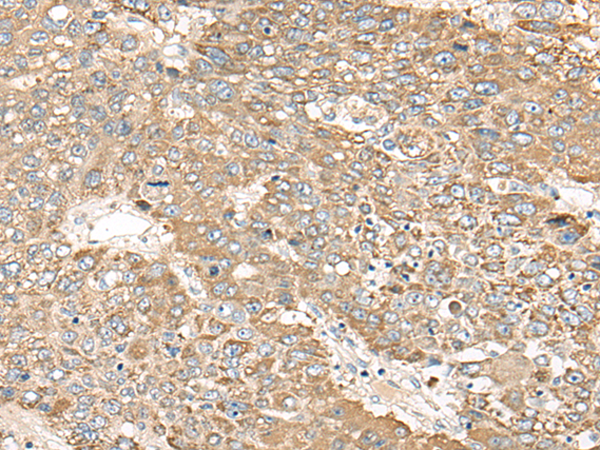 Rabbit Polyclonal Antibody to CATSPERE