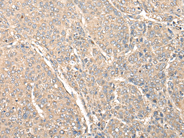 Rabbit Polyclonal Antibody to INAVA