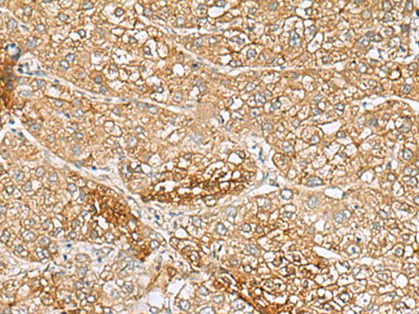 Rabbit Polyclonal Antibody to C1orf112