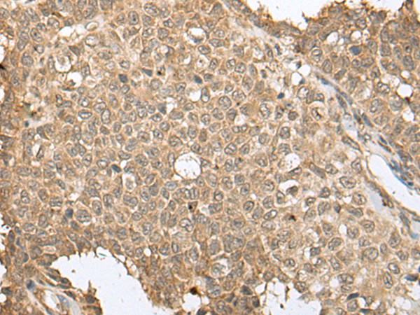 Rabbit Polyclonal Antibody to SPRTN