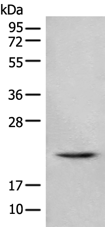 Rabbit Polyclonal Antibody to TSEN15