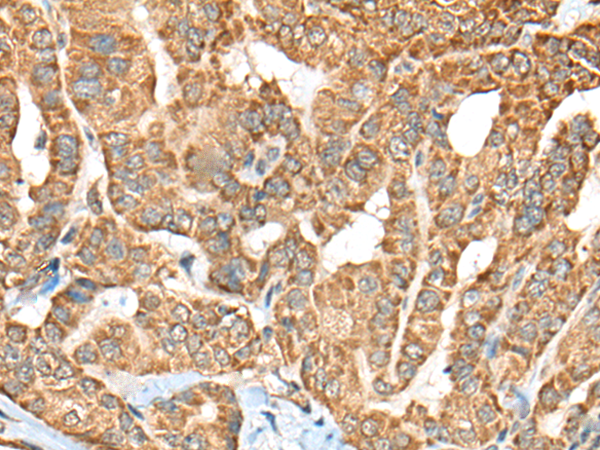 Rabbit Polyclonal Antibody to C1R