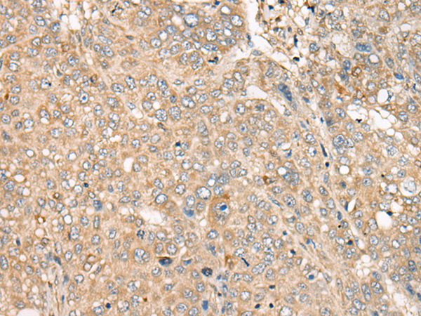 Rabbit Polyclonal Antibody to CFAP410