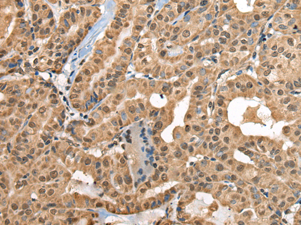 Rabbit Polyclonal Antibody to RTCB