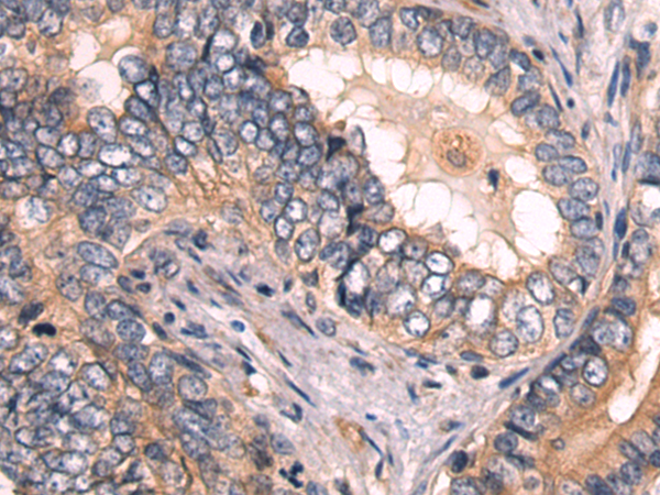 Rabbit Polyclonal Antibody to KLHL12