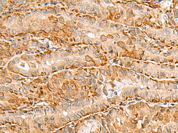 Rabbit Polyclonal Antibody to C3orf38