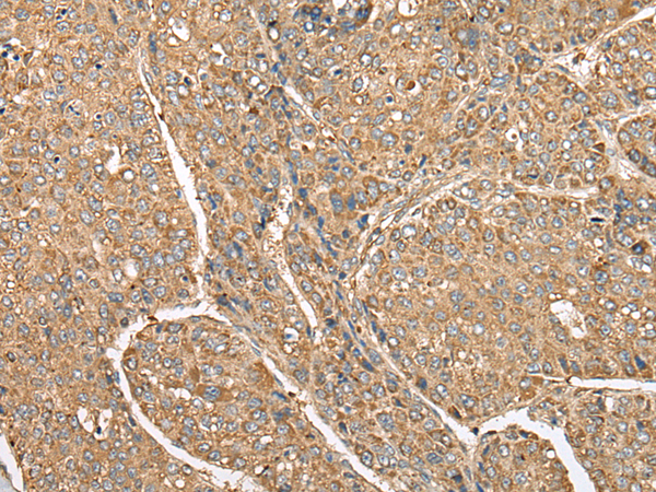 Rabbit Polyclonal Antibody to C5AR1