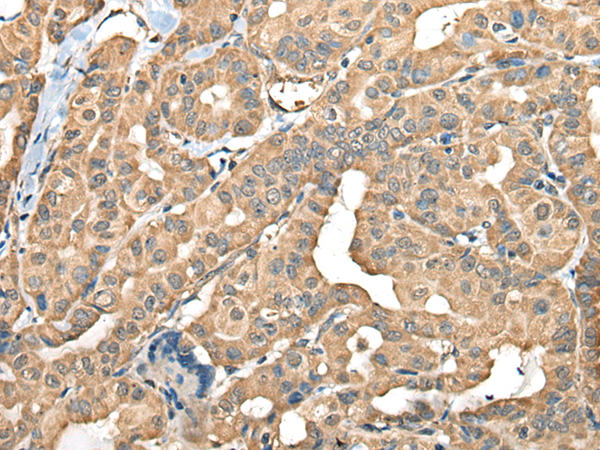Rabbit Polyclonal Antibody to FAM110B