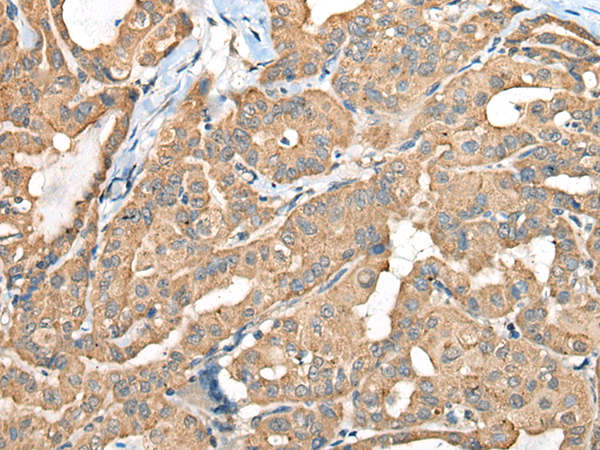 Rabbit Polyclonal Antibody to CA6