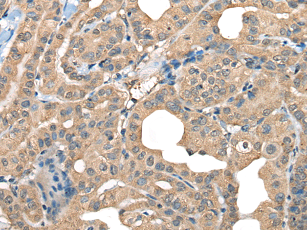 Rabbit Polyclonal Antibody to CABP5