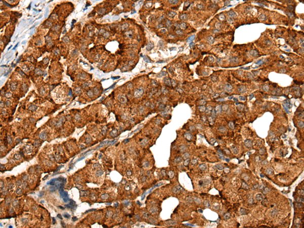 Rabbit Polyclonal Antibody to CDH16