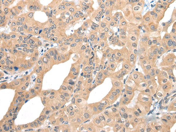 Rabbit Polyclonal Antibody to CAGE1