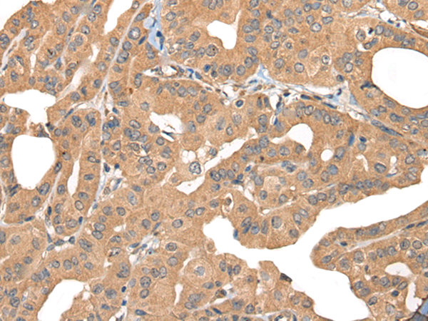 Rabbit Polyclonal Antibody to PPP3R1