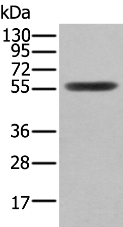 Rabbit Polyclonal Antibody to CLU/APO J