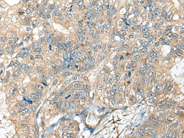 Rabbit Polyclonal Antibody to CASR