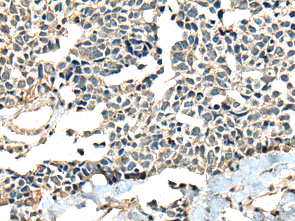 Rabbit Polyclonal Antibody to CALHM1