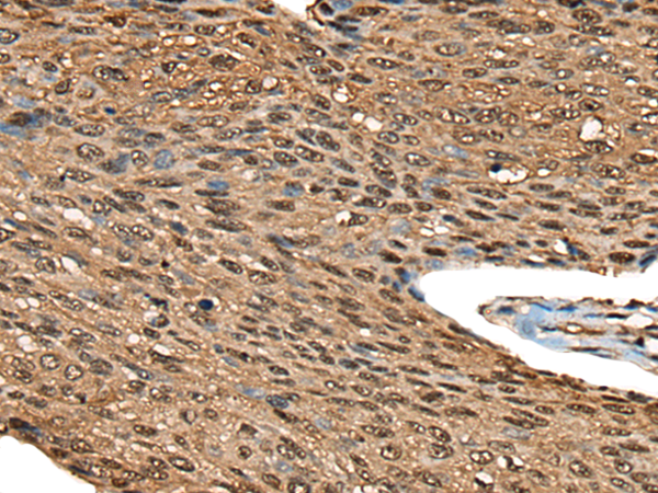 Rabbit Polyclonal Antibody to CALML5