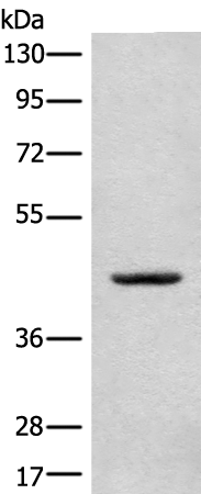Rabbit Polyclonal Antibody to CANT1
