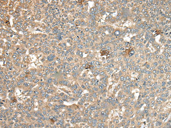 Rabbit Polyclonal Antibody to CA11