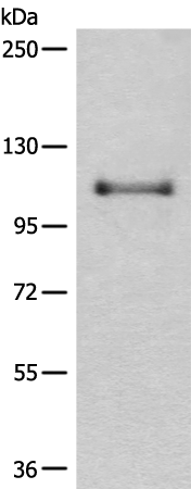 Rabbit Polyclonal Antibody to CASK