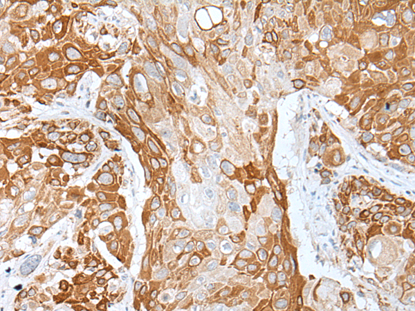 Rabbit Polyclonal Antibody to DAPK1