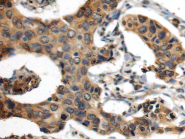 Rabbit Polyclonal Antibody to CAMP