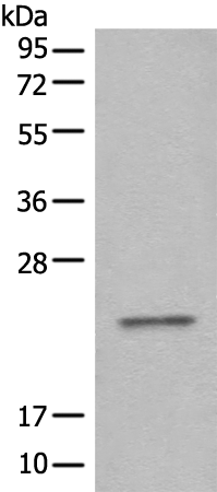 Rabbit Polyclonal Antibody to CBFB