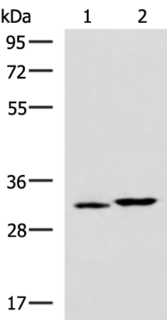 Rabbit Polyclonal Antibody to CBR3