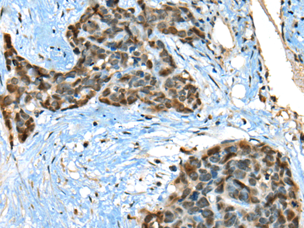 Rabbit Polyclonal Antibody to CCDC137