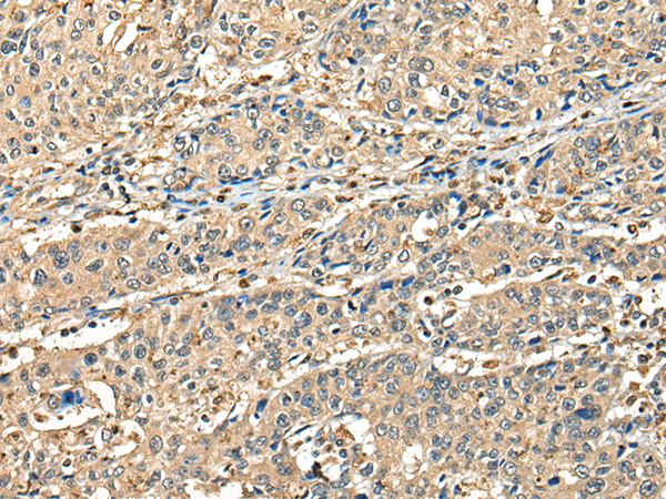 Rabbit Polyclonal Antibody to CCDC112